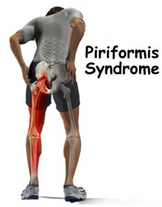 piriformis-syndrome-referral-pattern « Chiropractor Bloomington IL